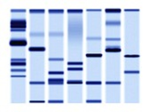 DNA sequencing gel, close up