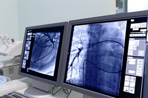 Imaging data (both clinical and non-clinical) makes up about 45% of this data volume in the healthcare industry and hence needs to be effectively managed ( Photo: Shutterstock) Imaging data (both clinical and non-clinical) makes up about 45% of this data volume in the healthcare industry and hence needs to be effectively managed ( Photo: Shutterstock)