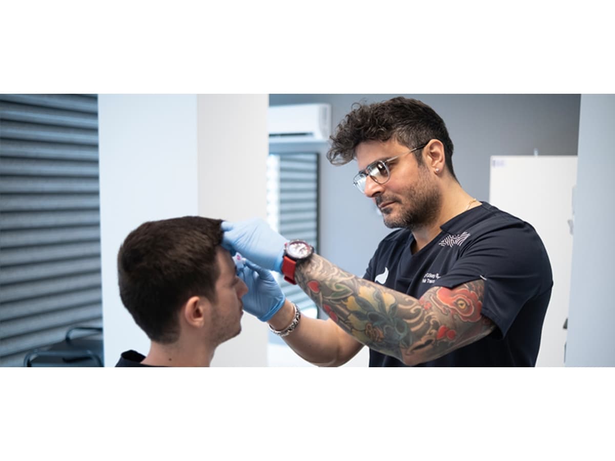 Hair transplant clinics in Turkey: A definitive guide to excellence