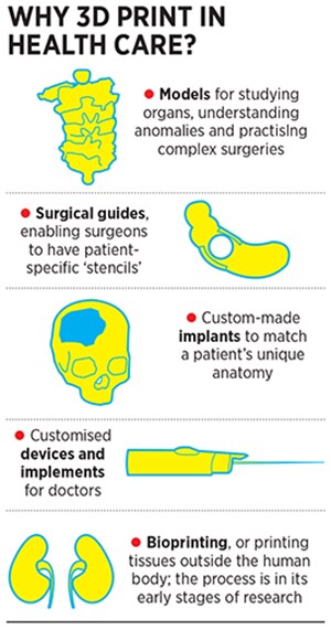 g_109319_3dprinting_healthace_280x210.jpg g_109319_3dprinting_healthace_280x210.jpg