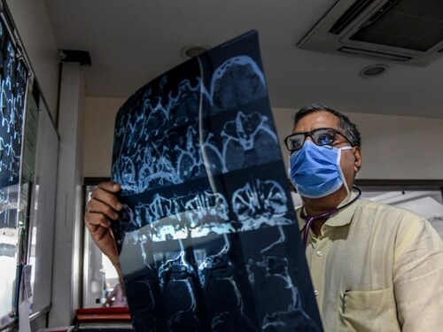 Forbes India Forbes India Image