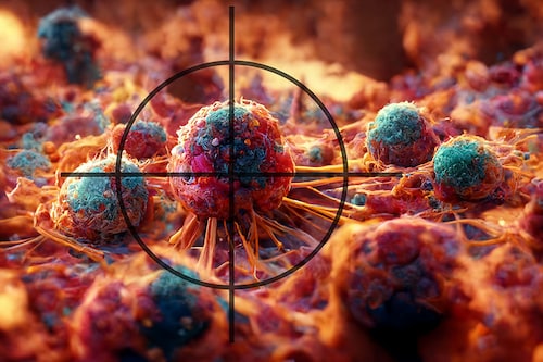As per the World Health Organization (WHO), cancer develops as normal cells undergo a transformation into tumour cells through a multi-stage process. Image: Shutterstock As per the World Health Organization (WHO), cancer develops as normal cells undergo a transformation into tumour cells through a multi-stage process. Image: Shutterstock