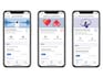 Apple's reach reshapes medical research