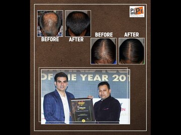 Dr. Snigdhodip Saha from Kolkata unfolds the mystery of Hairfall & Hair Regrowth treatment in India