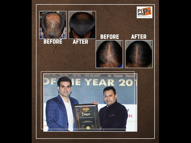 Dr. Snigdhodip Saha from Kolkata unfolds the mystery of Hairfall & Hair Regrowth treatment in India