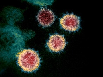 'Is There a Cure?' and answers to other Coronavirus Questions