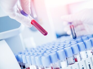 Why you shouldn't worry about studies showing waning Coronavirus antibodies