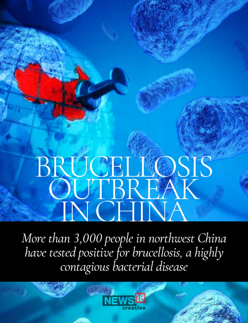 Brucellosis outbreak in China: What you need to know