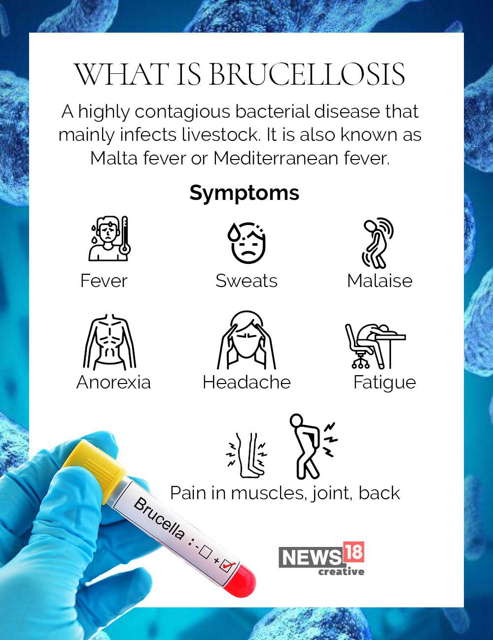Brucellosis outbreak in China: What you need to know