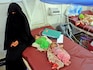 Famine stalks Yemen, as war drags on and foreign aid wanes