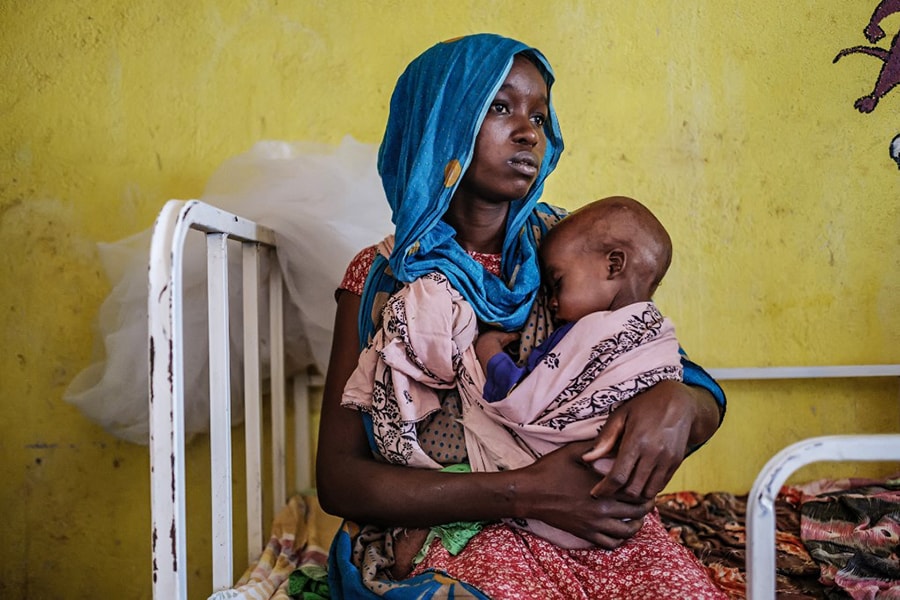 A woman holds a malnourished child at the nutrition unit of the Kelafo Health Center in the town of Kelafo, 120 kilometers from the city of Gode, Ethiopia, on April 7, 2022. The worst drought to hit the Horn of Africa for 40 years is pushing 20 million people towards starvation, according to the UN, destroying an age-old way of life and leaving many children suffering from severe malnutrition as it rips families apart. (Image: EDUARDO SOTERAS / AFP)